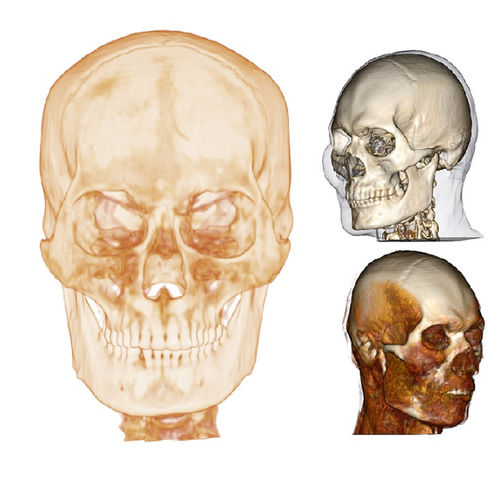 3D viewing software - Medical Design Studio - Anatomage - design / medical image import / 3D simulation