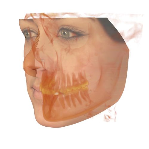 Visualization software - Anatomodel - Anatomage - diagnostic / planning / 3D simulation