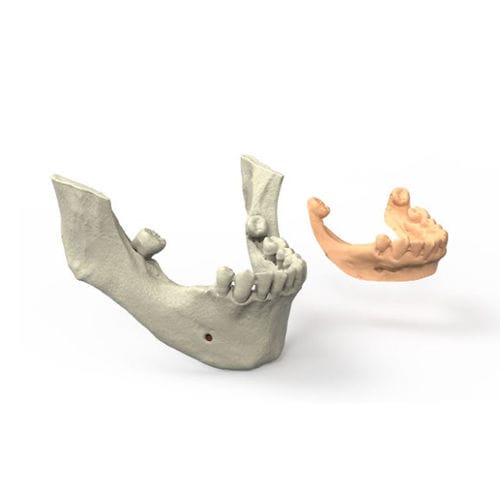 Dental software - 3DIEMME - for dental prosthesis design / for dental implant simulation / surgery