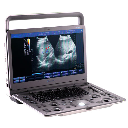 Portable ultrasound system - DUS – 5000 + - Advanced Instrumentations - for gynecological and obstetric ultrasound imaging / for abdominal and pelvic ultrasound imaging / for cardiovascular ultrasound imaging