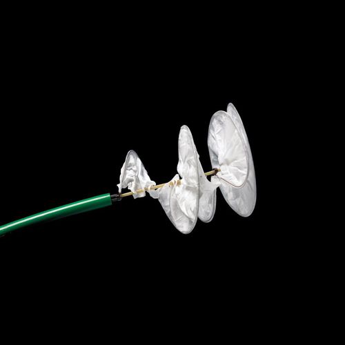 Atrial septal closure occlusion device HELEX® Gore