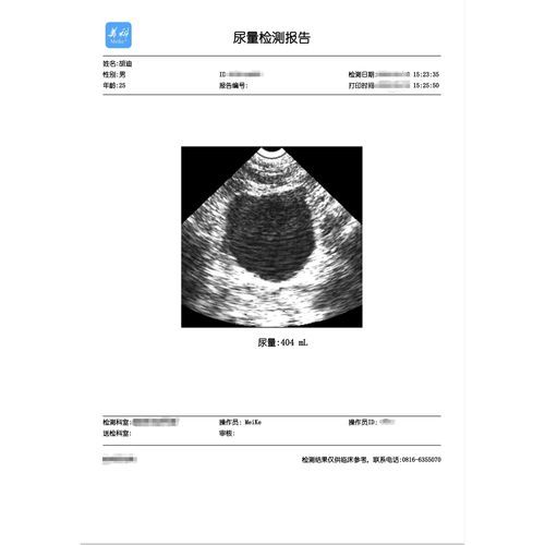 Printing software - Mianyang Meike Electronic Equipment - security / verification / urology