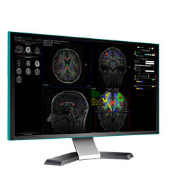 Analysis software - nordicBrainEx - NordicNeuroLab - visualization / reporting / quality control