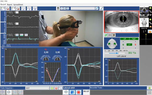 Test software - Instrumentation DIFRA - vestibular rehabilitation