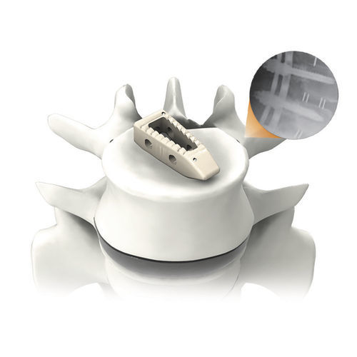 Thoraco-lumbar interbody fusion cage - PLATEAU®-P - Life Spine - posterior / PEEK