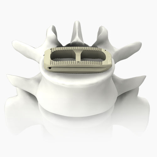Lumbar interbody fusion cage - PLATEAU®-X - Life Spine - lateral / PEEK