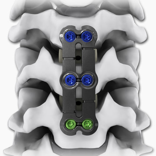 Cervical arthrodesis plate - KINETIC®-SL - Life Spine - locking / metallic / 2 levels