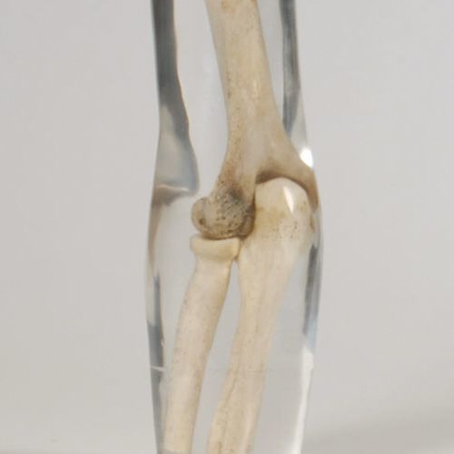 Radiography test phantom - 12713 - QUART X-Ray QA Solutions - arm / elbow