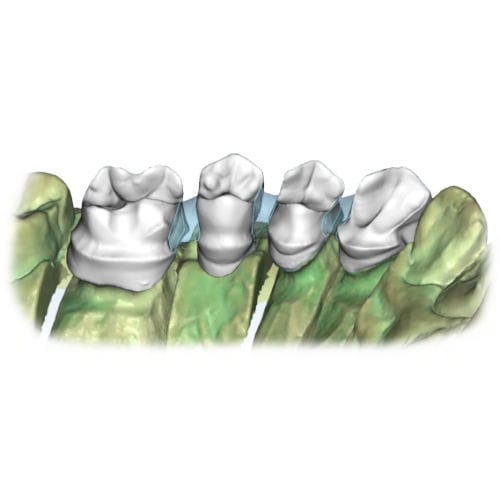 Training software - Restoration - AGE Solutions - CAD / dental / laboratory