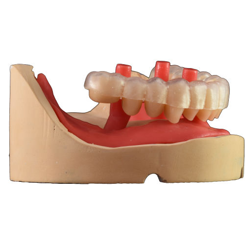 Scan software - Smile Creator - AGE Solutions - dental
