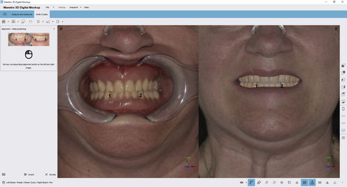 Diagnostic software - Digital Mockup - AGE Solutions - treatment / dental