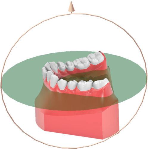 Analysis software - Maestro 3D ortho - Shining 3D - measurement / treatment / 3D printing