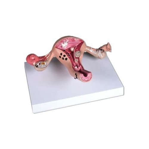 Uterus model - YA/U043B - Yuan Technology - for teaching