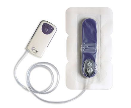 Battery-powered Negative Pressure Wound Therapy Unit - Prevena ...