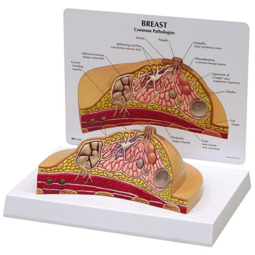 Breast model - 3450 - GPI Anatomicals - for teaching / for cancers / female