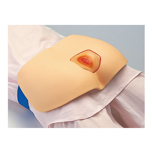 Decubitus ulcer treatment simulator - M156 - Sakamoto Model Corporation - buttock