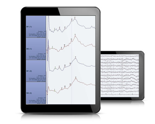 Analysis software - AlphaView - Dr. Grossegger & Drbal alpha trace medical systems - EEG / polysomnography / Windows