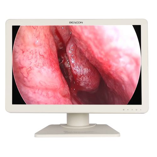 Medical display - E2421 - Shenzhen Beacon Display Technology - operating room / endoscopy / full HD
