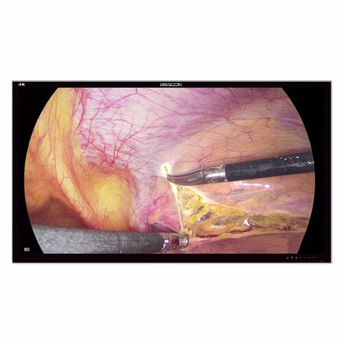 Endoscopy display - S5583P - Shenzhen Beacon Display Technology - surgical / 4K UHD / 55"