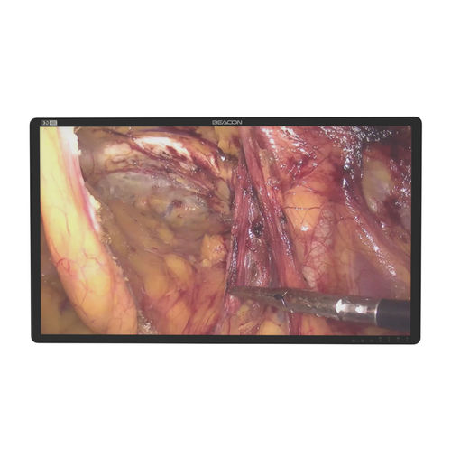 Operating room display - S3285P-3D - Shenzhen Beacon Display Technology - endoscopy / surgical / 4K
