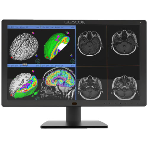 Diagnostic display - C411W - Shenzhen Beacon Display Technology - medical / medical imaging / 2560 × 1440