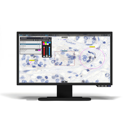 Virtual microscopy software - InstantViewer - 3DHISTECH Ltd. - management / viewer / sharing