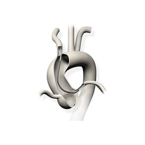 Guiding catheter - Profit™ - Nipro - aortic / 6 FR