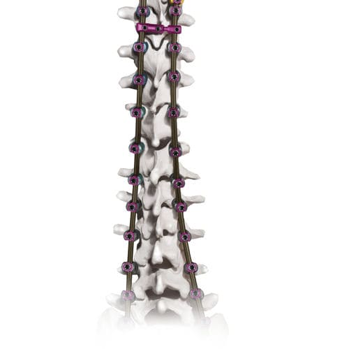 Thoraco-lumbo-sacral osteosynthesis unit - CREO AMP® - Globus Medical - posterior / adult