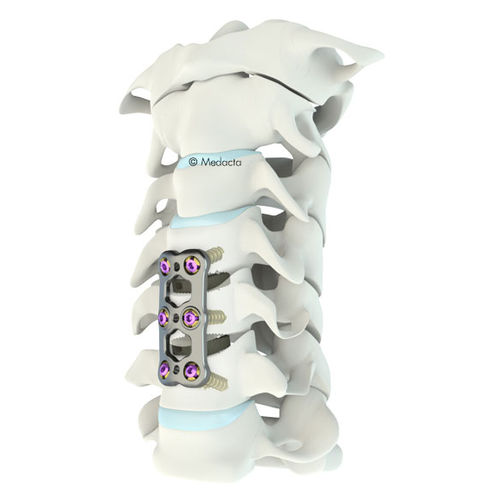 Cervical arthrodesis plate - Mecta®-C  - Medacta - locking / metallic