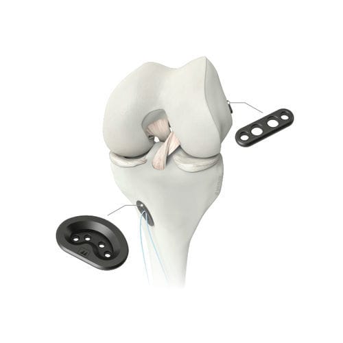 Anterior cruciate ligament ligament prosthesis - M-ARS - Medacta - synthetic