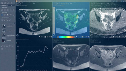 Analysis software module - MYRIAN®XP-FEMALE - Intrasense - visualization / clinical / pelvis