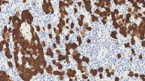Antibody - ALK-L-CE-H - Leica Biosystems - monoclonal antibody / immunohistochemistry / for histopathology