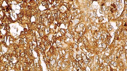 Monoclonal antibody - PA0963-U - Leica Biosystems - antibody / for oncology / for histopathology