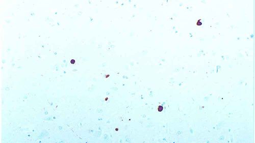 Monoclonal antibody - ASYN-L - Leica Biosystems - antibody / immunohistochemistry / for Western blot