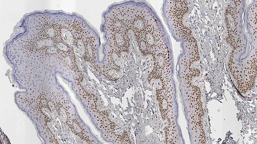 Monoclonal antibody - AR27 - Leica Biosystems - antibody / for histopathology / immunohistochemistry
