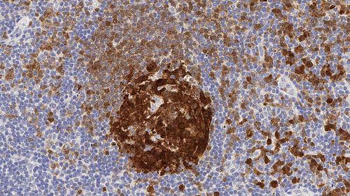 Antibody - BOB-1 - Leica Biosystems - monoclonal antibody / for histopathology / diagnostic