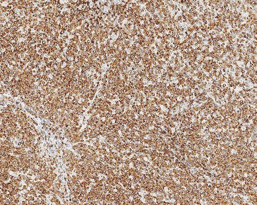 Antibody - Bcl-2  - Leica Biosystems - monoclonal antibody / tissue / immunohistochemistry