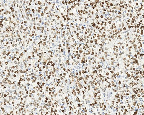 Antibody - Bcl-6  - Leica Biosystems - monoclonal antibody / for research / diagnostic