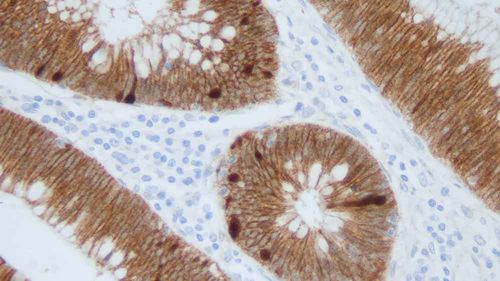 Monoclonal antibody - B-CAT-L-CE - Leica Biosystems - antibody / tissue / immunohistochemistry