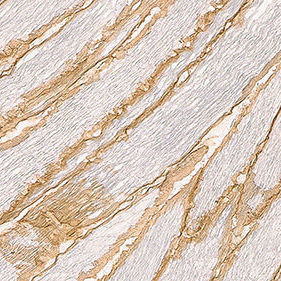 Monoclonal antibody - B-DG-CE - Leica Biosystems - diagnostic / immunohistochemistry / for immunodetection