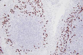 Nucleic acid reagent - PB0669 - Leica Biosystems - FFPE tissues / immunoglobulin / chromogenic