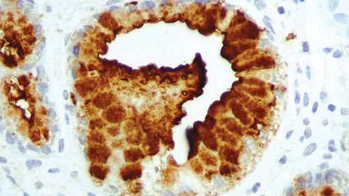 Monoclonal antibody - PA0424-U - Leica Biosystems - for histopathology / diagnostic / tissue