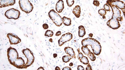 Medium reagent - calponin-basic - Leica Biosystems ...