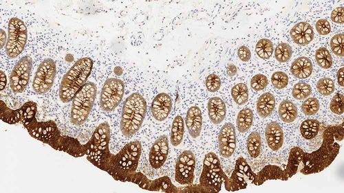 Antibody - CEA-609-L-CE - Leica Biosystems - monoclonal antibody / immunohistochemistry / diagnostic