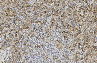 Monoclonal antibody - CD4 - Leica Biosystems - antibody / for histopathology / immunohistochemistry