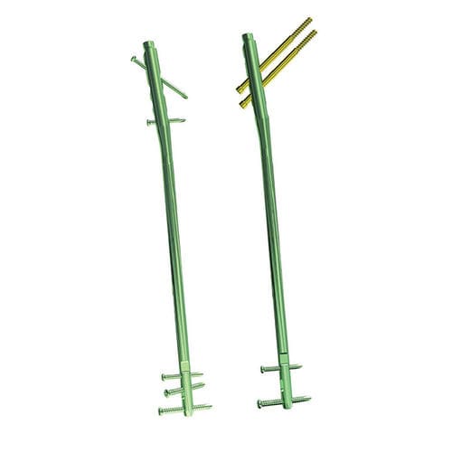 Femoral intramedullary nail - II - Lepu Medical - titanium