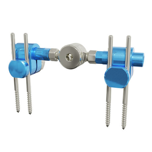 Metacarpophalangeal joint external fixation system - SMART  - MIKAI - tubular / adult
