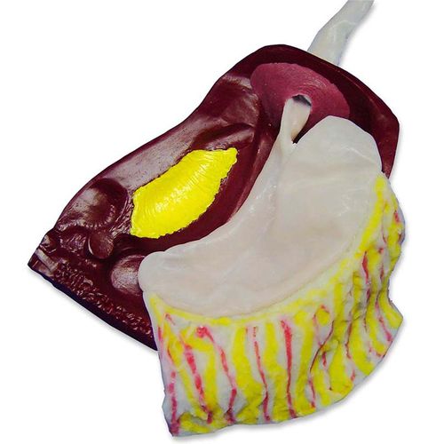 Abdominal model - LNF-10 - Simulab Corporation - surgery / training / laparoscopic
