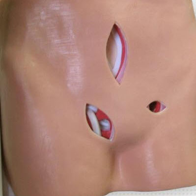 Body anatomical model - HTM-30 - Simulab Corporation - epigastric / ventral / testicle
