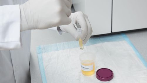 Fentanyl assay kit - ARK™  - Siemens Healthineers - Laboratory Diagnostics - for abused drugs / urine